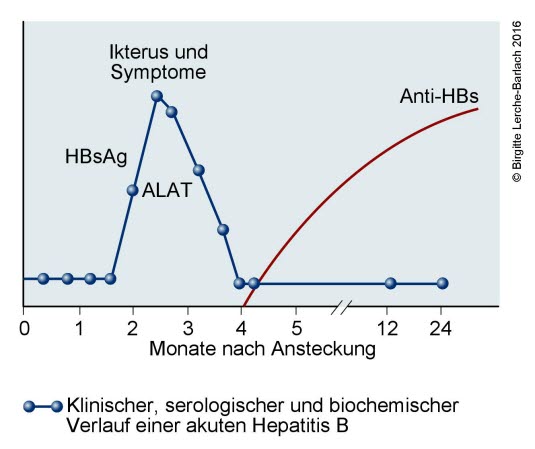 Hepatitis-B-Verlaufskurve