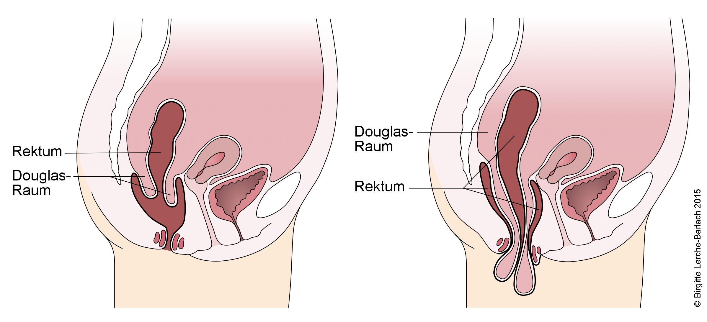 Rus porno aktrisasi Viola Elena Mixaylova