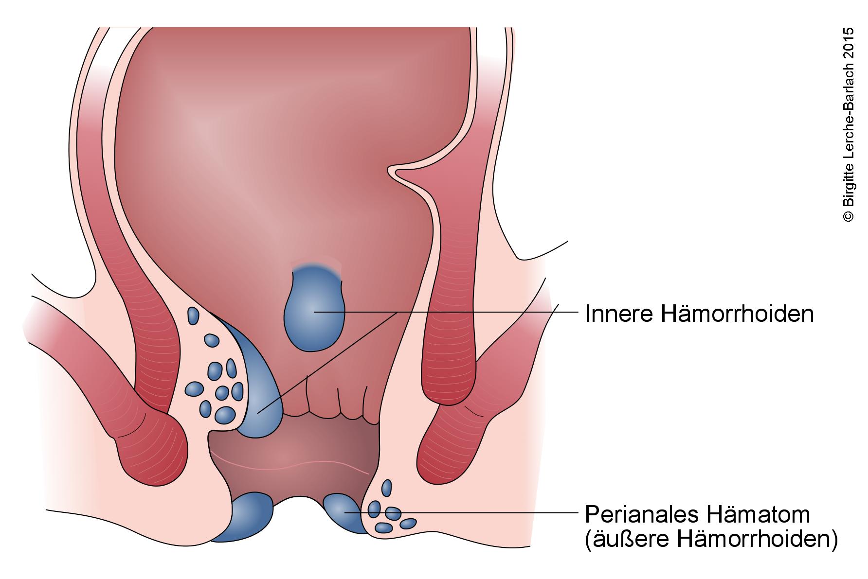 Suluklar bilan davolash vaginal narx