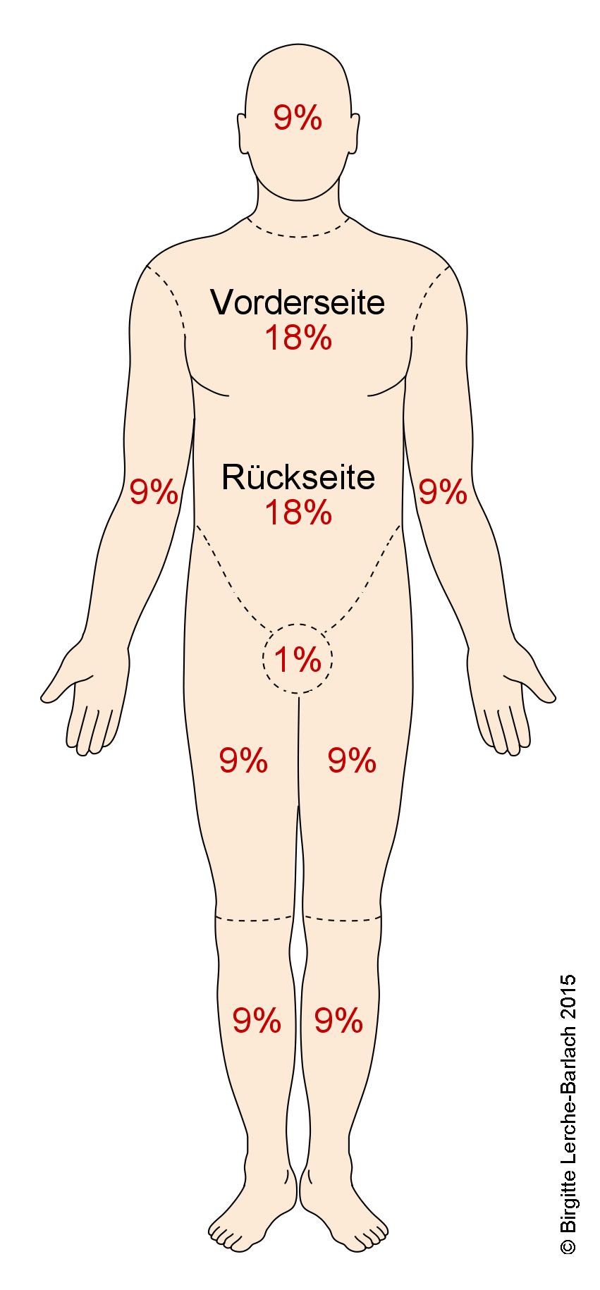 Neun-Prozent-Regel bei Verbrennungen.jpg