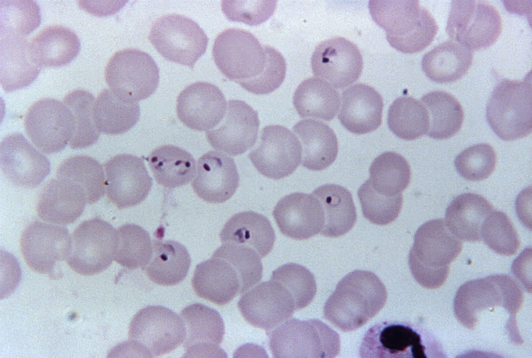 4243-2-plasmodium-falciparum.jpg