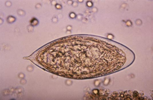 Eier des Erregers Schistosoma haematobium (Quelle: Centers for Disease Control and Prevention)