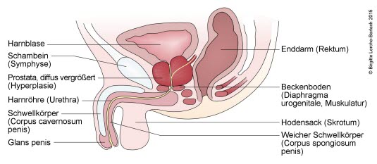 Prostata: Hypertrophie