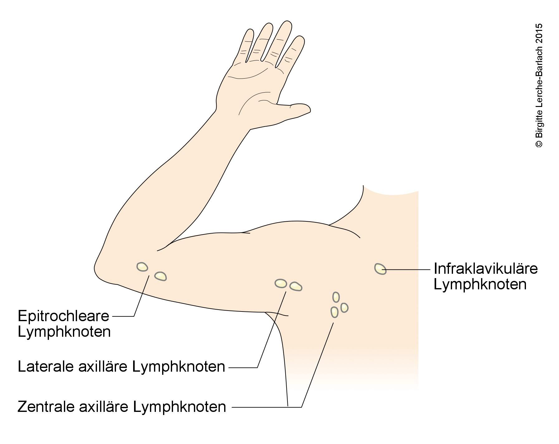 Axill re Lymphknoten