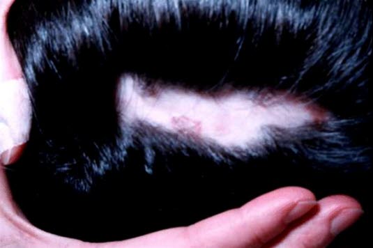 Eine Alopecia areata beginnt häufig mit einer oder einigen wenigen münzgroßen haarlosen Stellen, die in Laufe einiger Wochen schrittweise größer werden. Es sind kleine, 2–3 mm lange Härchen zu erkennen.