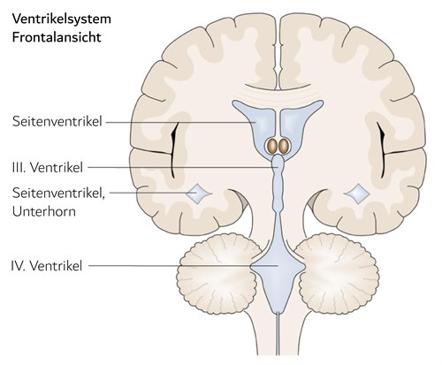 Ventrikelsystem, Frontalansicht