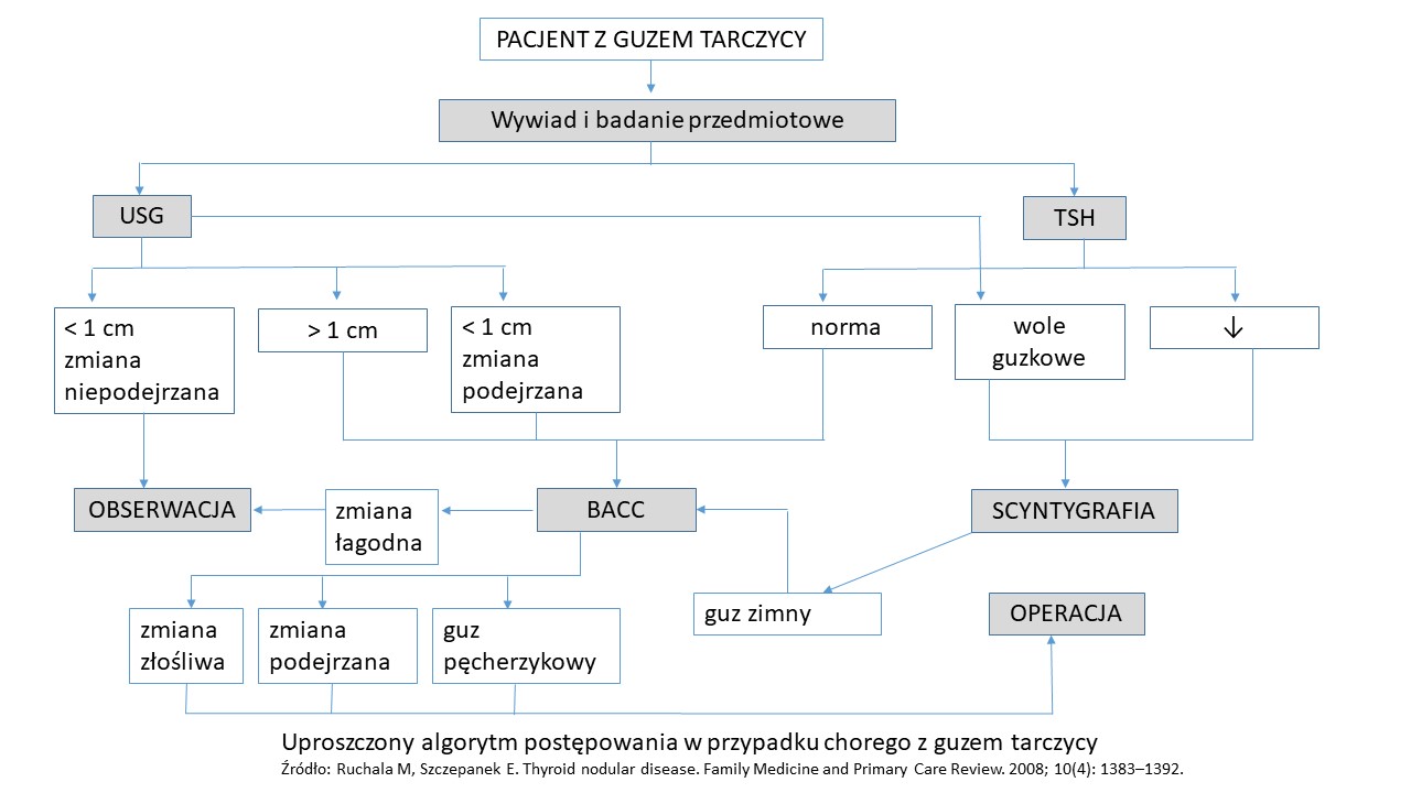 Guzki tarczycy algorytm.jpg